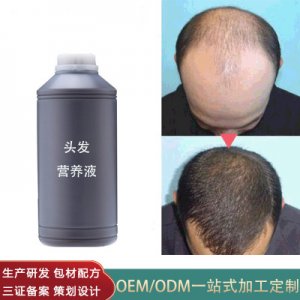 何首烏頭皮營養(yǎng)液代加工貼牌OEM/ODM