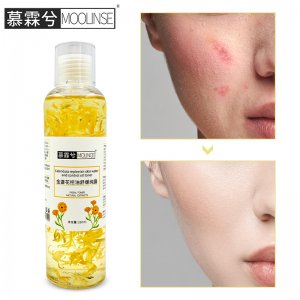 慕霖兮金盞花爽膚水OEM/ODM代加工
