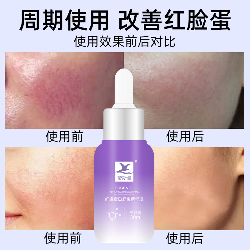 去除紅血絲增厚角質層改善敏感肌膚修復臉部泛紅高原紅化妝品批發(fā)OEM代加工